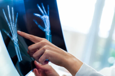 Female hand pointing at x ray sheet.